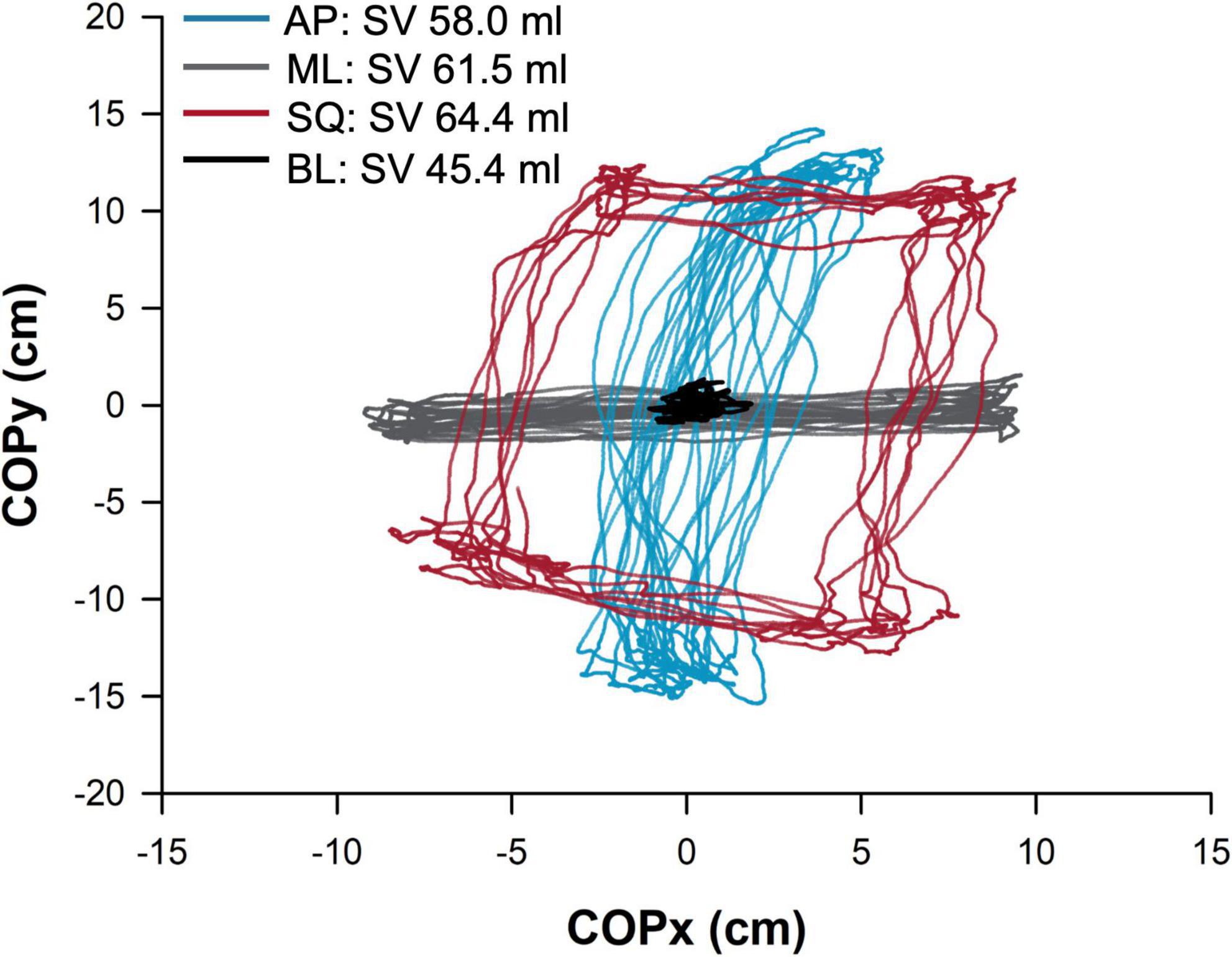 Exaggerated postural sway improves orthostatic cardiovascular and cerebrovascular control